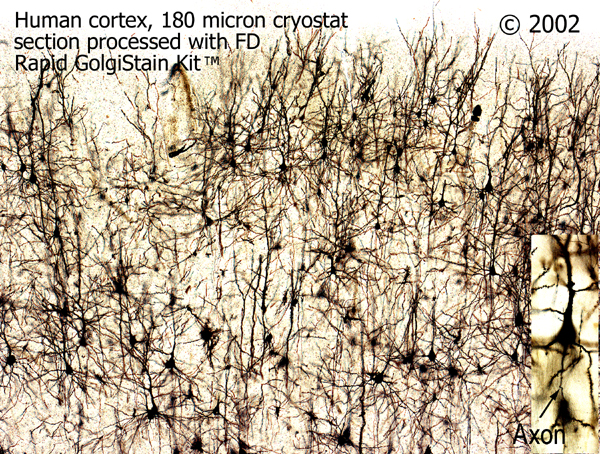 Rapid Golgi Stain Kit for Fast Neuronal Analysis - FD Neuro